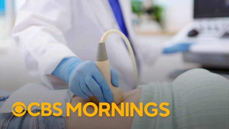 Read more about the article Expert on how fibroids impact women’s health, available treatments